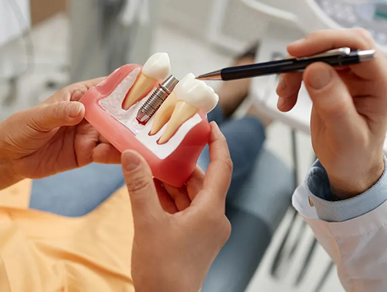 Our Implant Services in New Tampa